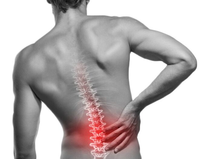 Podes desfacerte facilmente da dor na columna vertebral debido á osteocondrose cunha esterilla de acupresión Motion Mat